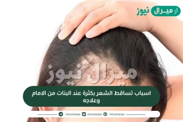 اسباب تساقط الشعر بكثرة عند البنات من الامام وعلاجه