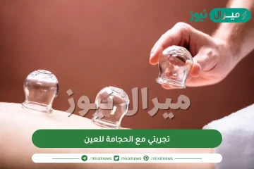 تجربتي مع الحجامة للعين