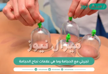 تجربتي مع الحجامة وما هي علامات نجاح الحجامة