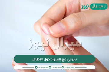 تجربتي مع السواد حول الأظافر وأسبابه وعلاجه بأفضل الكريمات والوصفات