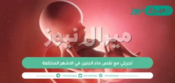 تجربتي مع نقص ماء الجنين في الاشهر المختلفة