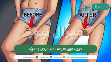 حرق دهون الارداف عند الرجل والمرأة