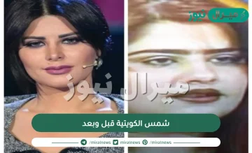 صور شمس الكويتية قبل وبعد