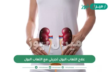 علاج التهاب البول تجربتي مع التهاب البول