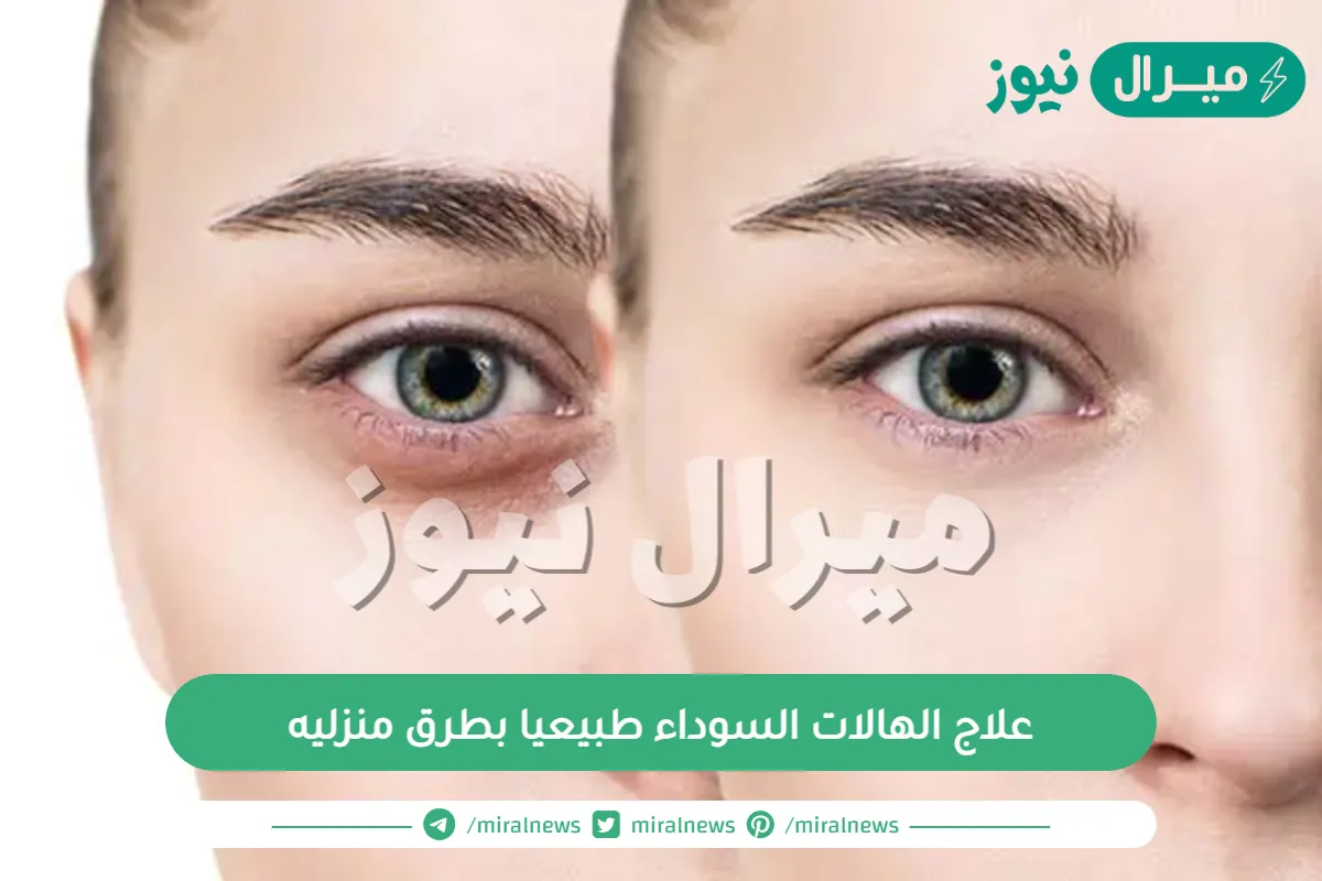 علاج الهالات السوداء طبيعيا بطرق منزليه