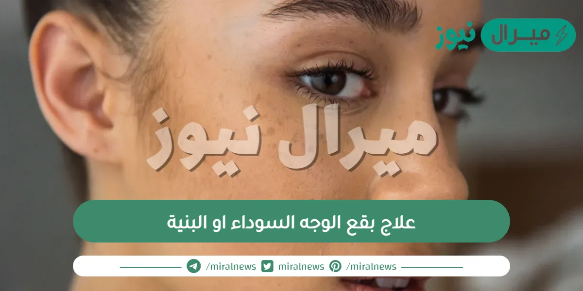 علاج بقع الوجه السوداء او البنية