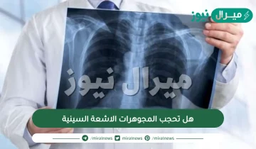 هل تحجب المجوهرات الاشعة السينية