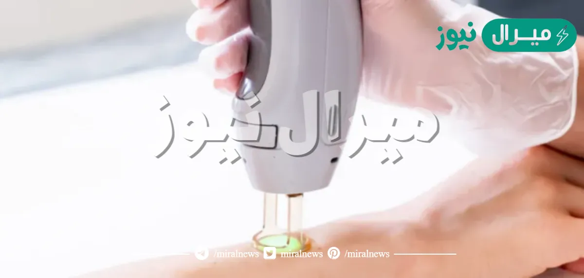 افضل جهاز ليزر لازالة الشعر في العيادات