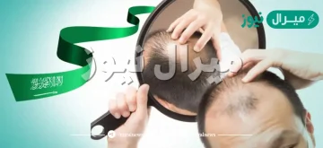 افضل مركز لزراعة الشعر في السعودية