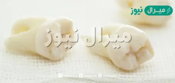 تفسير حلم خلع الضرس في المنام