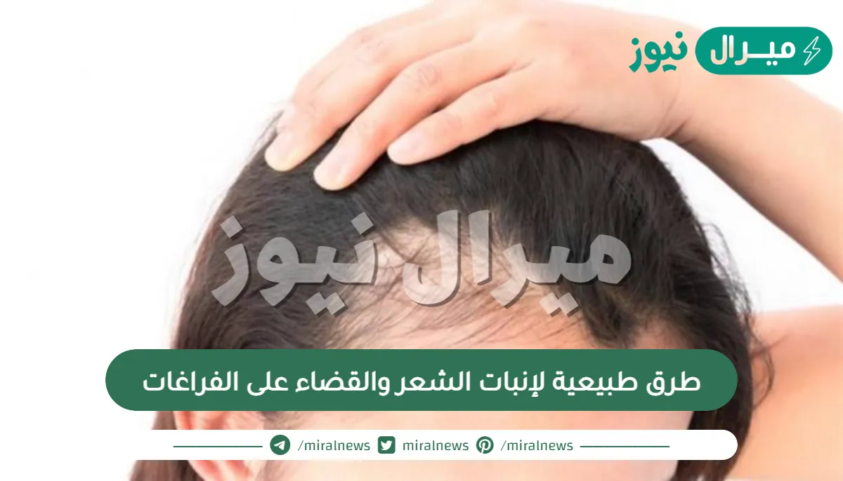 وداعاً لتساقط الشعر والصلع.. طرق طبيعية لإنبات الشعر والقضاء على الفراغات الموجودة به