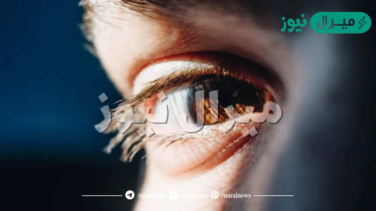 كيف تحافظ على سلامة عينك ارشادات