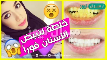 أفضل وصفة طبيعية لتبييض وتقشير الأسنان في 5 دقائق