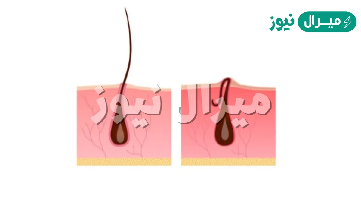 اقوى كريم لإزالة شعر الوجه والجسم كله من الجذور بمكون عجيب في منزلك وتبيض فوري للمناطق الداكنة