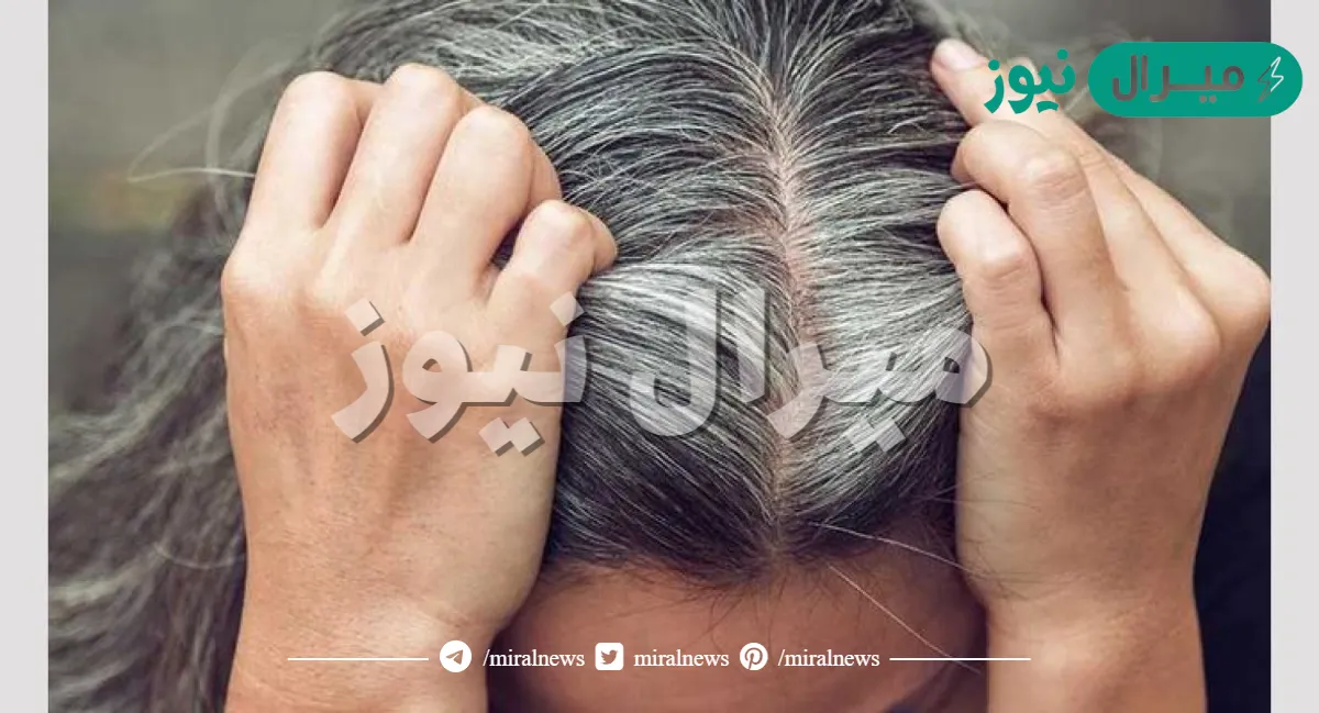 احذر من الشيخوخة..الأمراض التي تسبب شيب الشعر المبكر وطرق الوقاية منه ومعرفة أسبابه