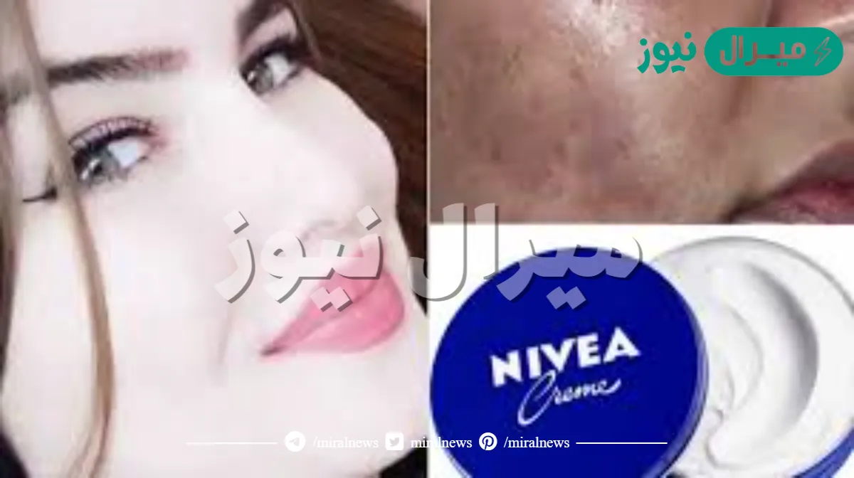 النشا وكريم نيفيا الرهيب لإزالة التصبغات والكلف لبشرة بيضاء بياض كالثلج