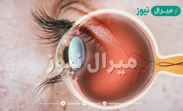 فسر لماذا تعد القرنية عنصر التجميع الرئيس للأشعة في العين