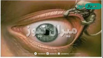 كيف اعرف من اصابني بالعين وما علامات الاصابة بالعين