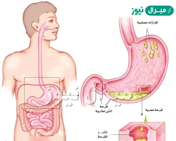 ما الجزء الذي يحدث فيه معظم الهضم الكيميائي؟