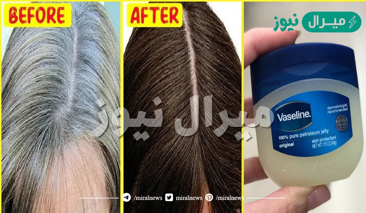 لن تصدق معلقة من الفازلين للتخلص من شيب الشعر والشيب المبكر نهائيا بدون صبغات