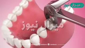 هل خلع السن يفطر الصائم إسلام ويب