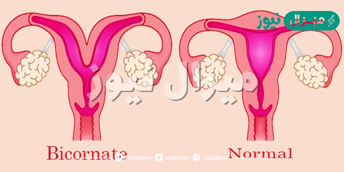 أعراض القرينة في الرحم للعزباء والمتزوجة وطرق علاج القرينة بالأعشاب الطبية