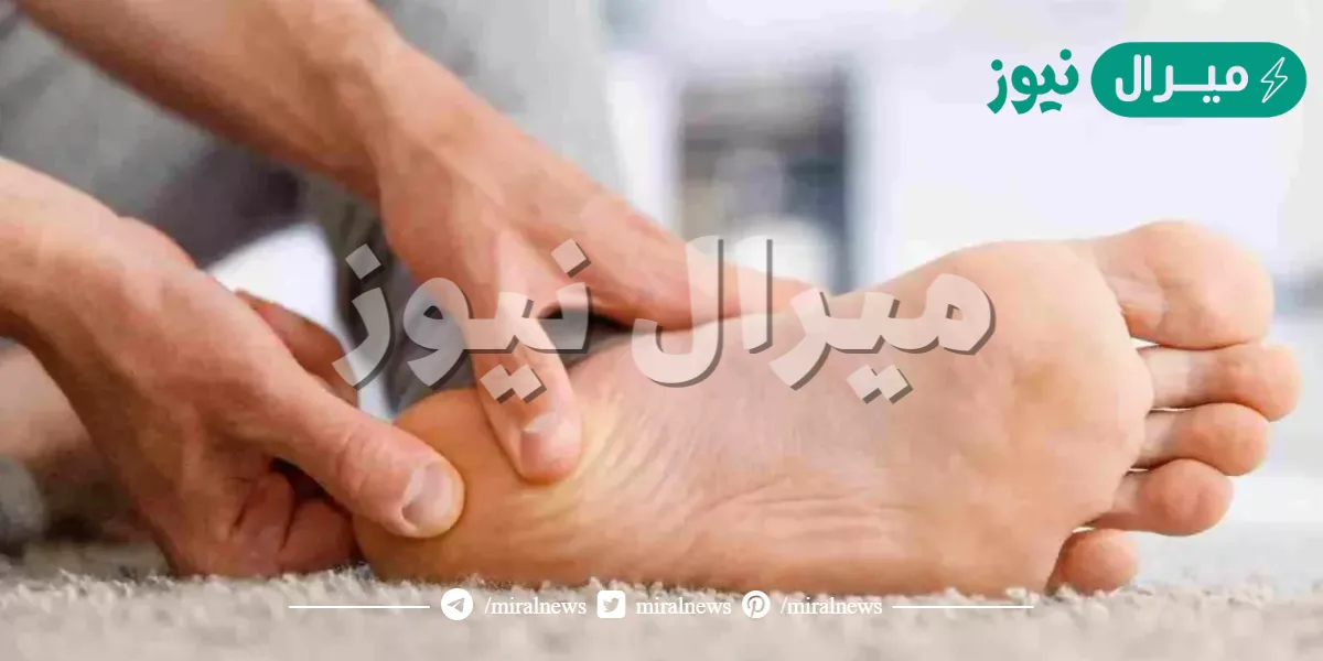 أفضل طرق لعلاج الشويكة بالاعشاب والتخلص منها بشكل نهائي