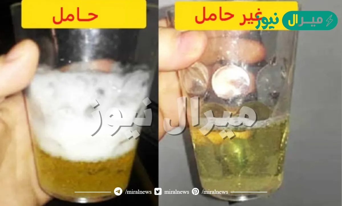 تحليل الحمل بالملح بالصور