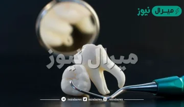 تفسير حلم ان ضرسي يهتز في المنام للعزباء والمتزوجة والرجل لابن سيرين ودلالاته