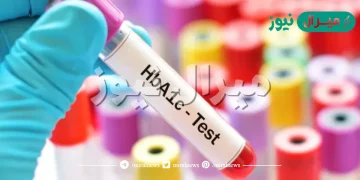 جدول معدل السكر التراكمي الطبيعي واعراض ارتفاع السكر التراكمي