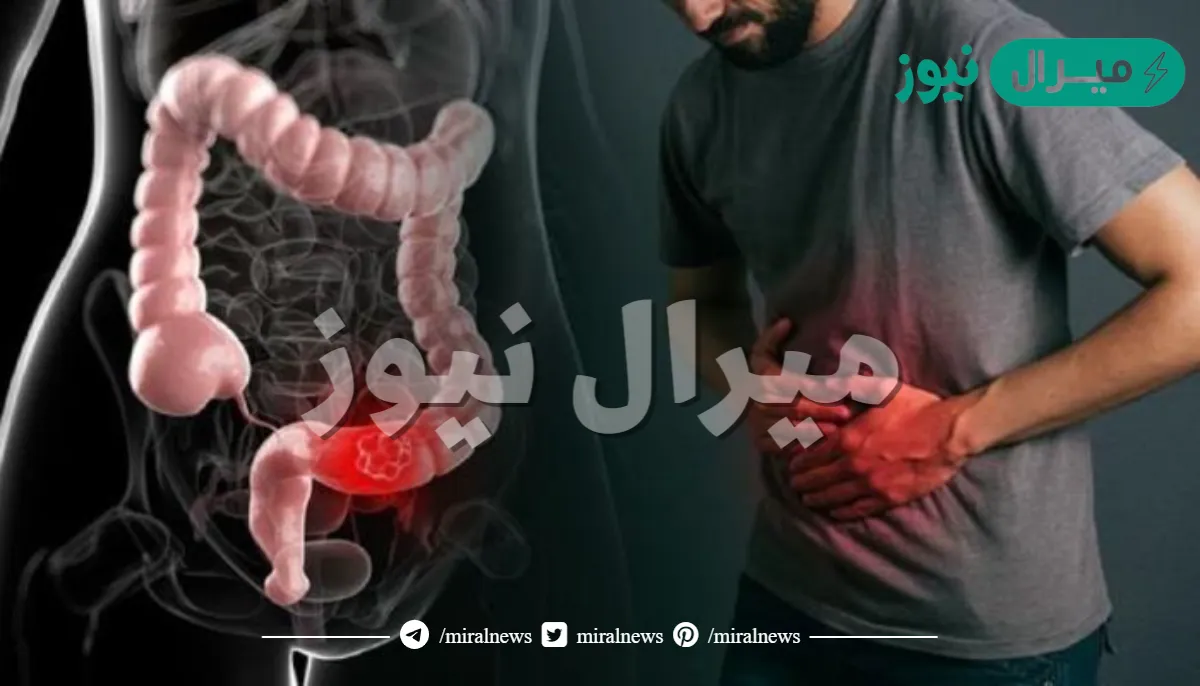 طرق علاج الامساك المزمن