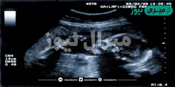 في اي شهر يمكن معرفة جنس الجنين