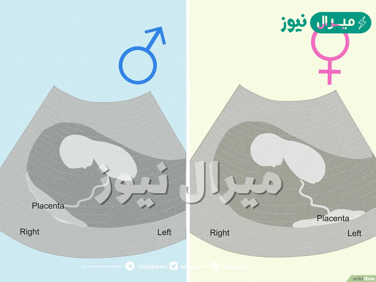 كيف اعرف نوع الجنين داخل الرحم
