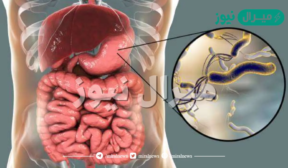 كيفية علاج جرثومة المعدة بالقرآن والطب النبوي والأعشاب