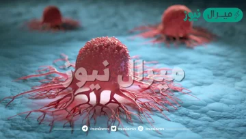 ما هو مرض الكانسر