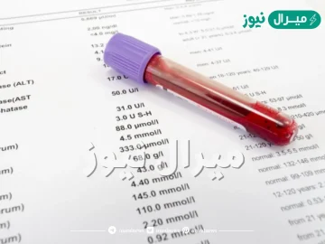 متى يظهر الحمل في تحليل الدم العادي وهل ممكن أن لا يظهر الحمل في تحليل الدم العادي