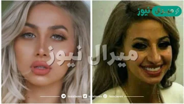 مودل روز قبل وبعد عملية التجميل