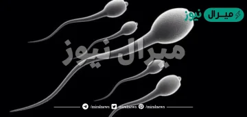 نسبة 97 تشوهات لها علاج وما هي أسباب وطرق علاج تشوهات الحيوانات المنوية