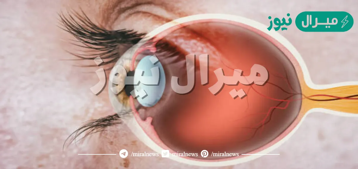 أي جزء من العين يتجمع عليه الضوء ؟