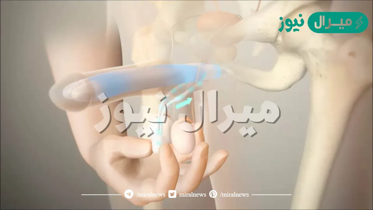 تجربتي مع الدعامه الذكريه | تجربتي مع الدعامه الذكرية العمر 65 عام