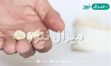 تفسير حلم سقوط الضرس في اليد