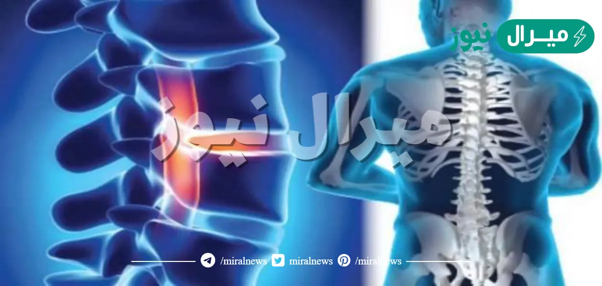 كم عدد الفقرات في العمود الفقري