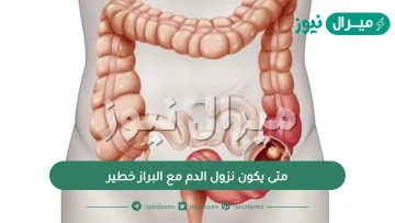 متى يكون نزول الدم مع البراز خطير