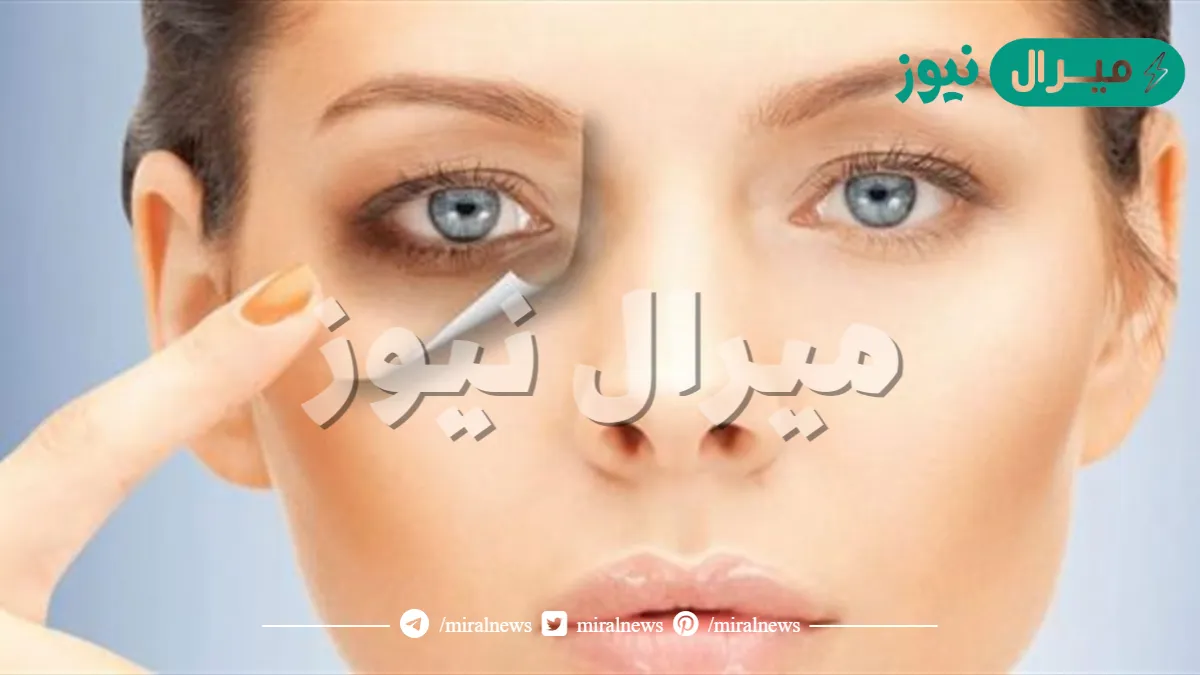 وداعًا للهالات السوداء.. اصنعي بنفسك كريم للقضاء على الهالات بمكونات طبيعية واحصلي على عيون مُشرقة
