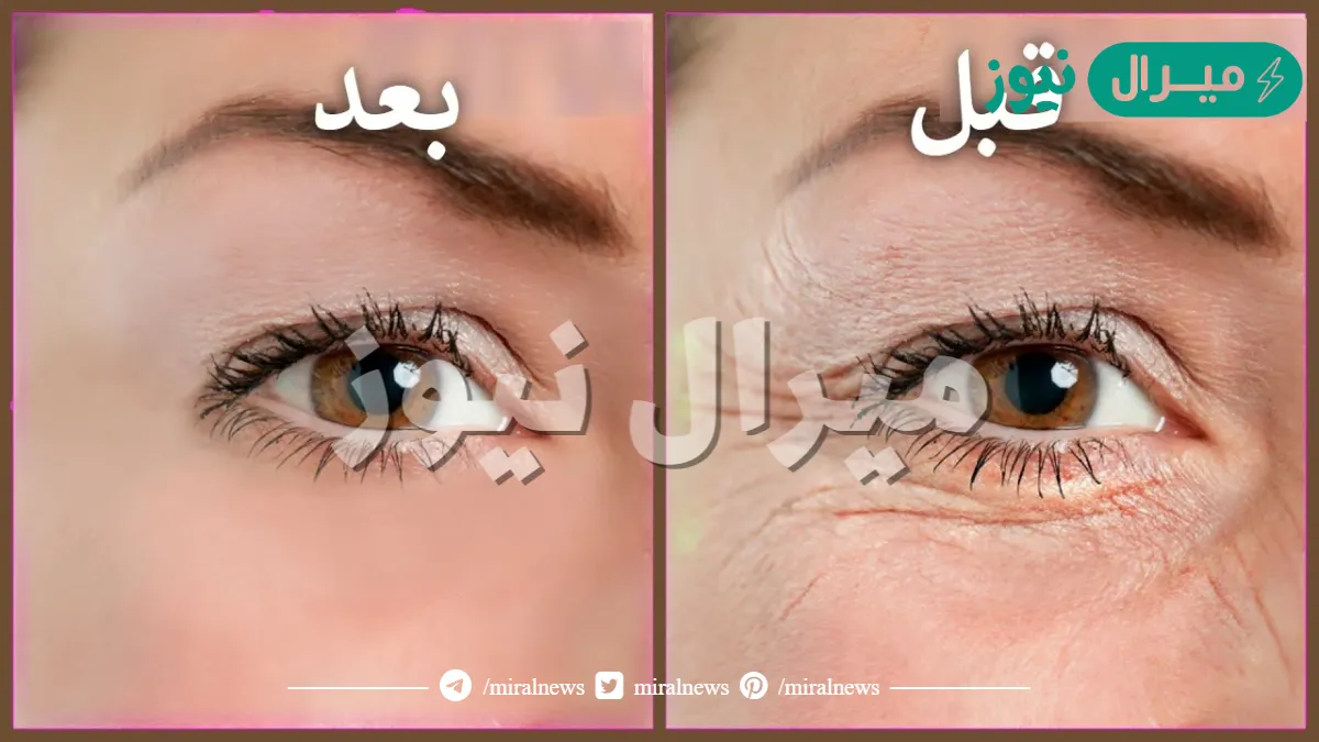 بشرة ممتلئة ومشدودة.. أقوى وصفة طبيعية لشد البشرة والتخلص من التجاعيد