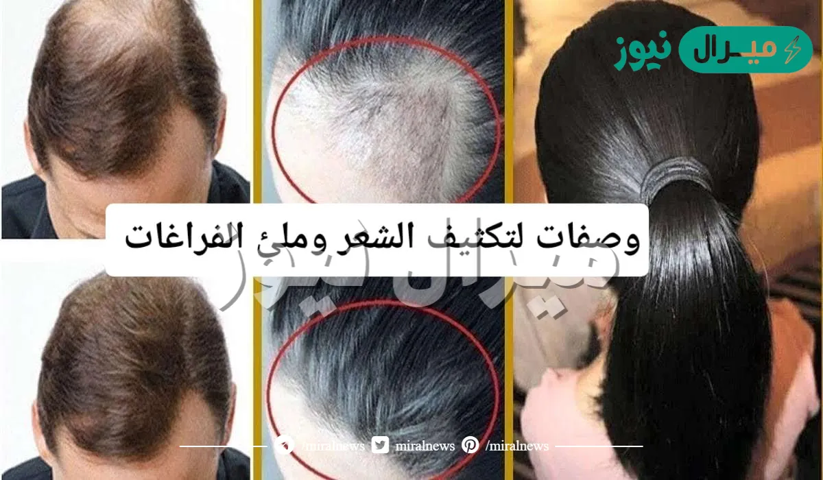 طريقة تكثيف الشعر وملء الفراغات في وقت قصير بـ 4 خلطات سحرية