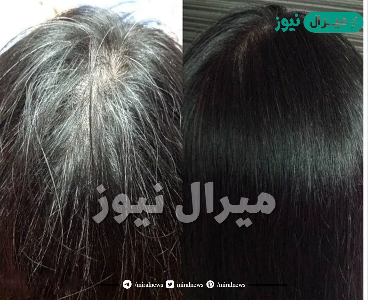 جددى دائما من نفسك وكونى متالقة.. طرق طبيعية للتخلص من شيب الشعر بدون صبغات ولا كيماويات جربية بنفسك وشوفي الفرق