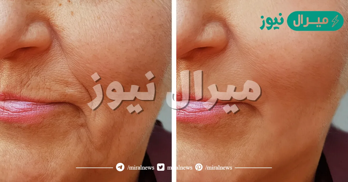 أقوى كولاجين طبيعي لعلاج مشاكل البشرة.. طريقة عمل صابونة لبان الذكر بكل سهولة في البيت واحصلي على بشرة مشدودة وناعمة وصافية