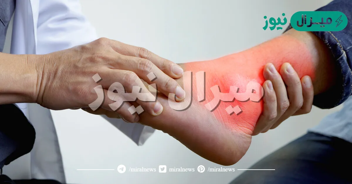 ماهو مرض النقرس؟ تعرف على الأعراض الأسباب والعلاج وطرق الوقاية منه