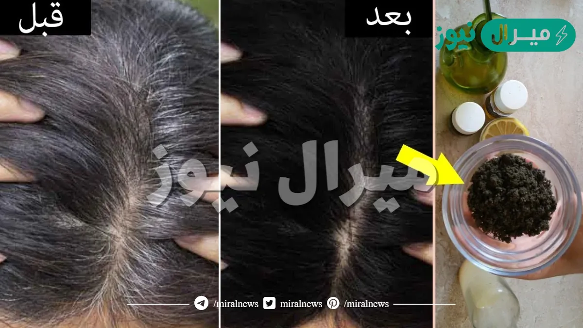 قولي وداعا لشيب الشعر… وصفات طبيعية للتخلص من شيب الشعر بدون صبغات ولا مواد كيمائية